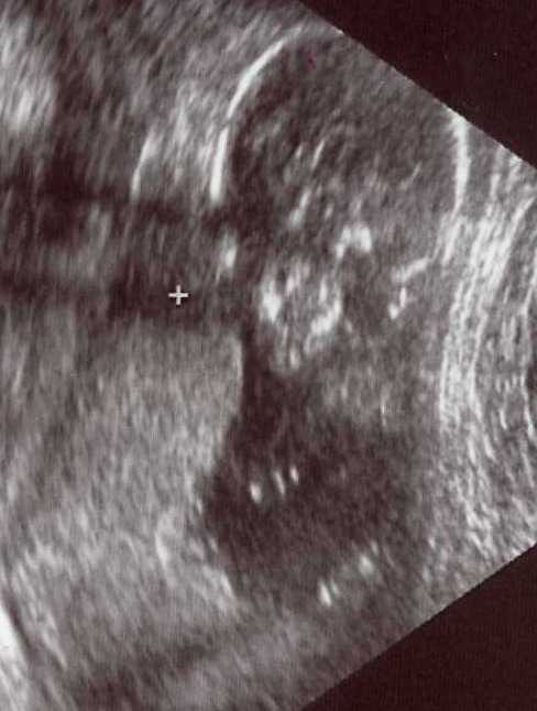 [baby_ultrasound.jpg]