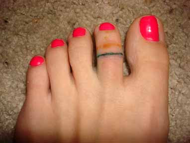 picture of Toe ring tattoo