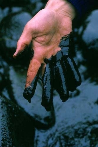 [oily+hand.jpg]