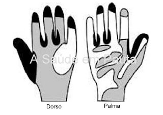 Esquema das áreas das mãos para ilustrar o modo de lavagem.