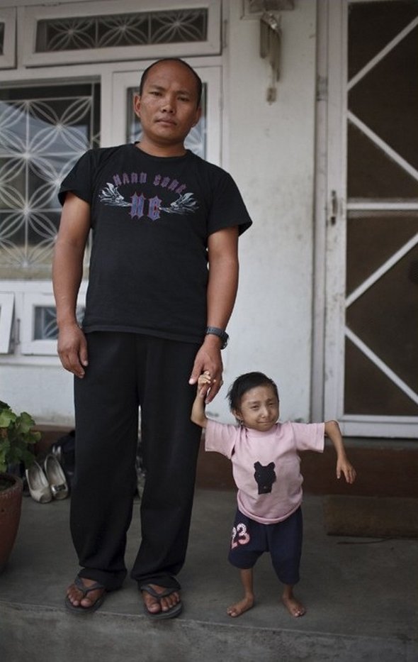 Самого взрослого человека. Хагендра тапа Магар рост. Самый маленький человек в мире Хагендра тапа Магар. Хагендра тапа Магар житель Непала. Низкий человек.