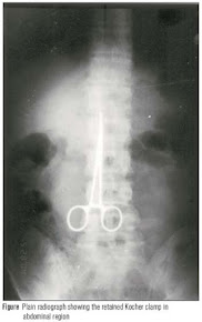 Development of a system to detect surgical material retained in the patients during operation