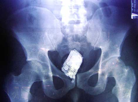 [cell+phone+up+ass.jpg]