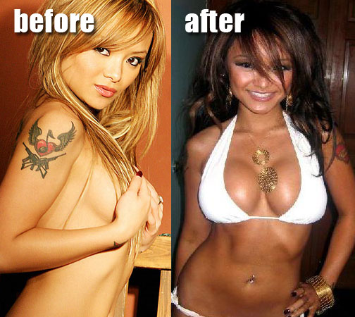 Casey's fiance Tila Tequila is also no stranger to plastic surgery and 