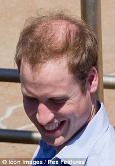 [prince+william+bald.jpg]