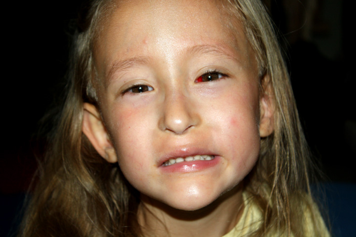 [2009.07.10HEyesAfter.jpg]