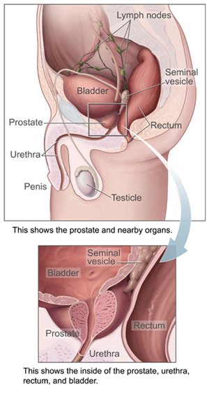 [63-treatments+for+prostate+cancer.jpg]