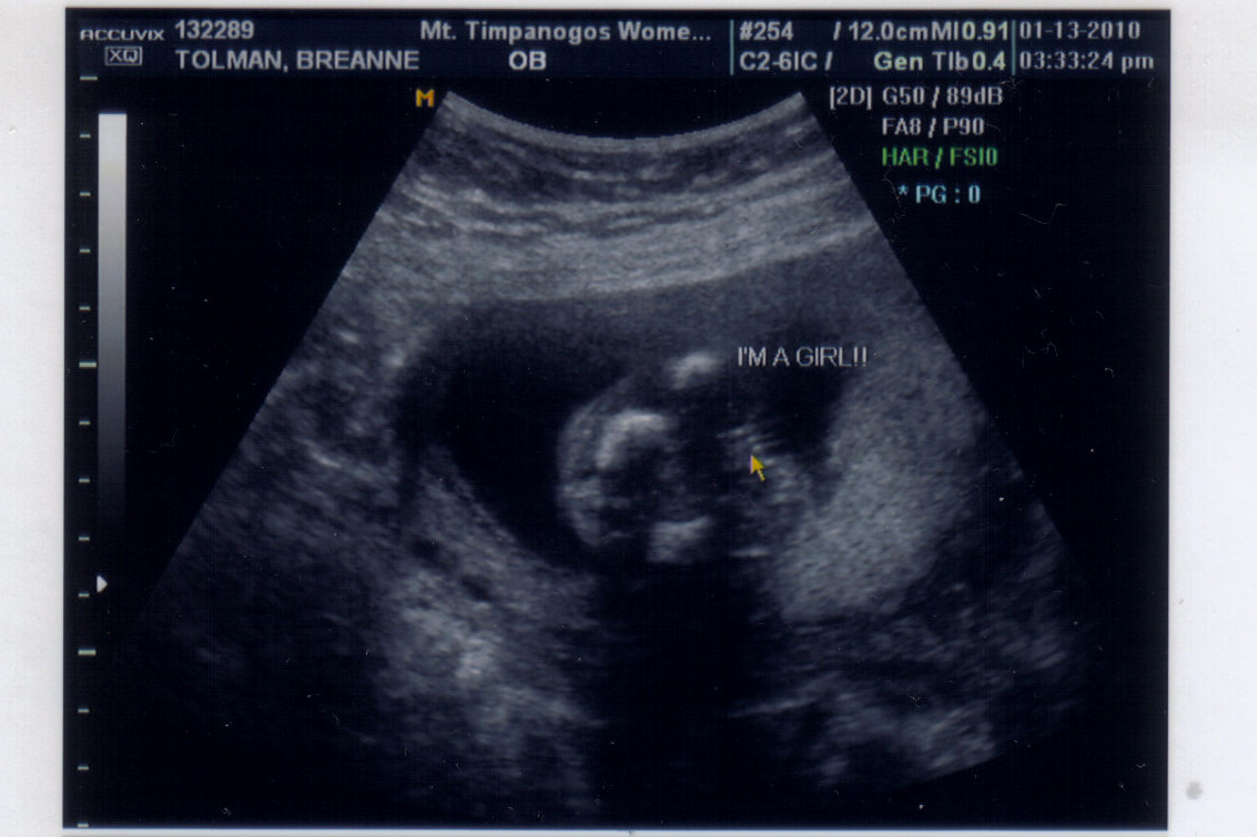 [baby+#3+Ultrasound-2.jpg]