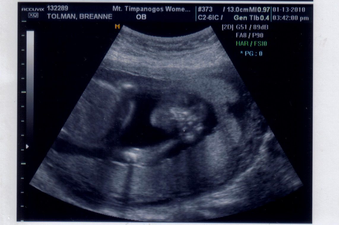 [baby+#3+Ultrasound-1.jpg]