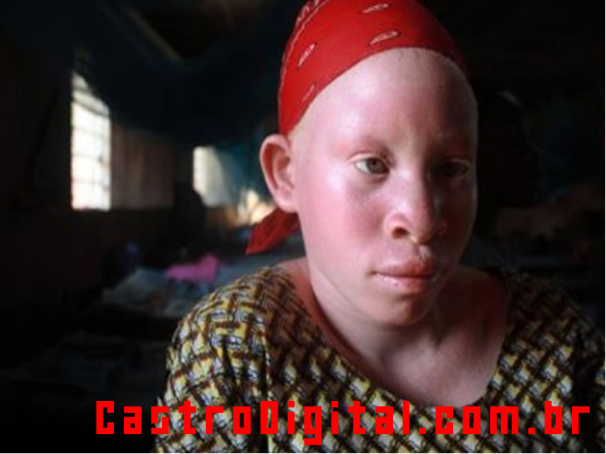 [negros-albinos-africa-07.jpg]