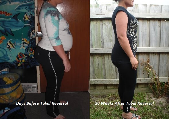 Altace Side Effects Weight Gain