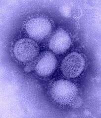 Virus H1 N1