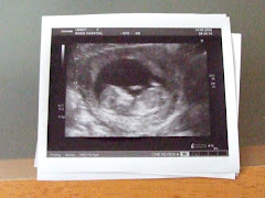 Scan at 12 Weeks and 2 Days