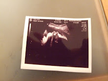 36 Week Scan