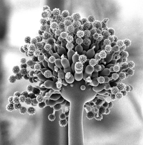 [asexual-structures-of-aspergillus-niger.jpg]