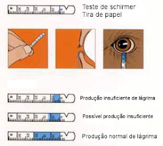 Teste de Schirmmer