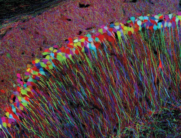 [Connect-brain.jpg]