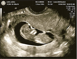 Sonogram 4/6/09