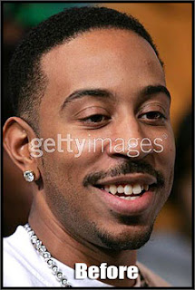 ludacris teeth