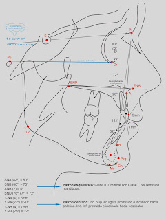 Curso Online de Ortodoncia: Cefalometria Steiner
