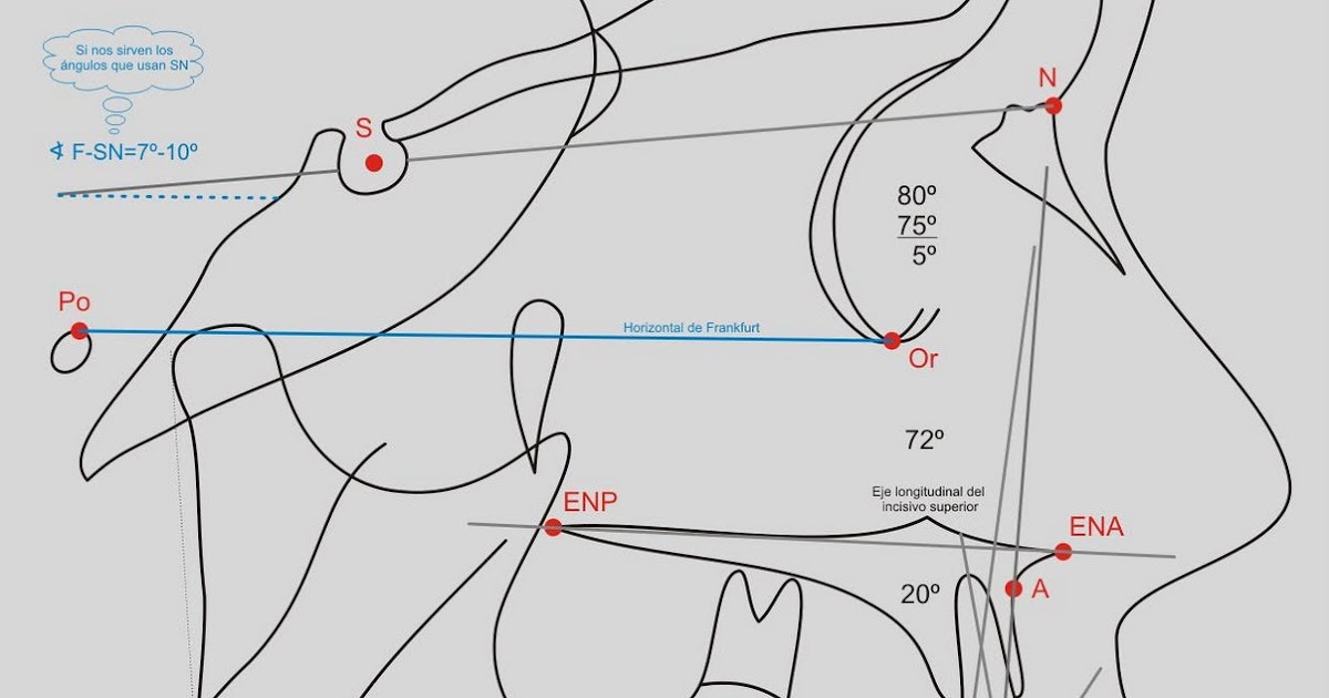 Curso Online de Ortodoncia: Cefalometria Steiner