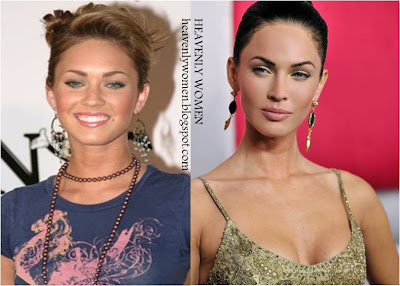 Megan Fox Before and After Plastic Surgery
