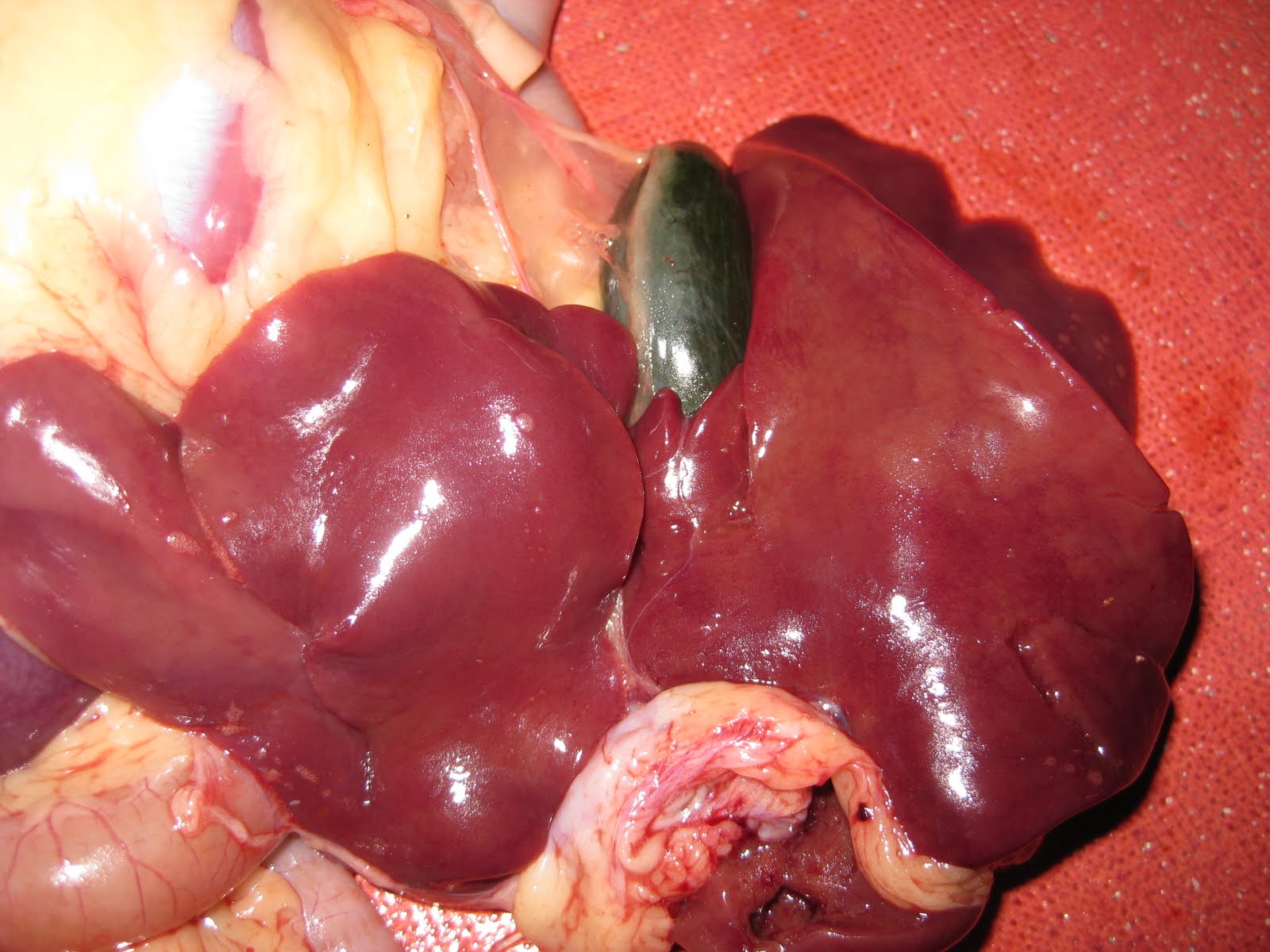 Healthy Gallbladder Real