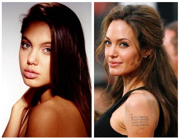 Plastic Surgery Before And After: Angelina Jolie Chin Implant