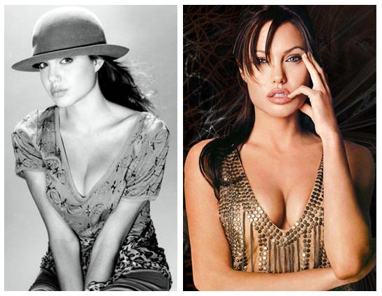 Angelina Jolie Before And After. Through plastic surgery, she has filled out 