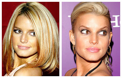 Plastic Surgery Before And After: Jessica Simpson Plastic Surgery