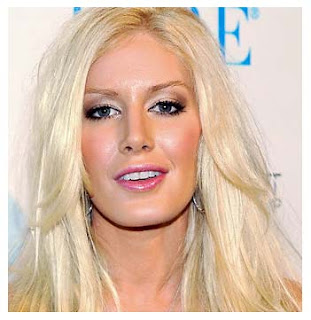 Heidi Montag Before After Plastic Surgery