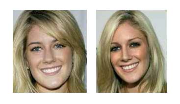 Plastic Surgery Before After: Heidi Montag Plastic Surgery