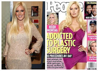Heidi Montag Plastic Surgery Before And After