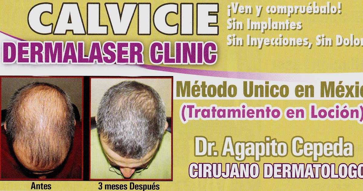 Laser Clinic Reynosa Tamps