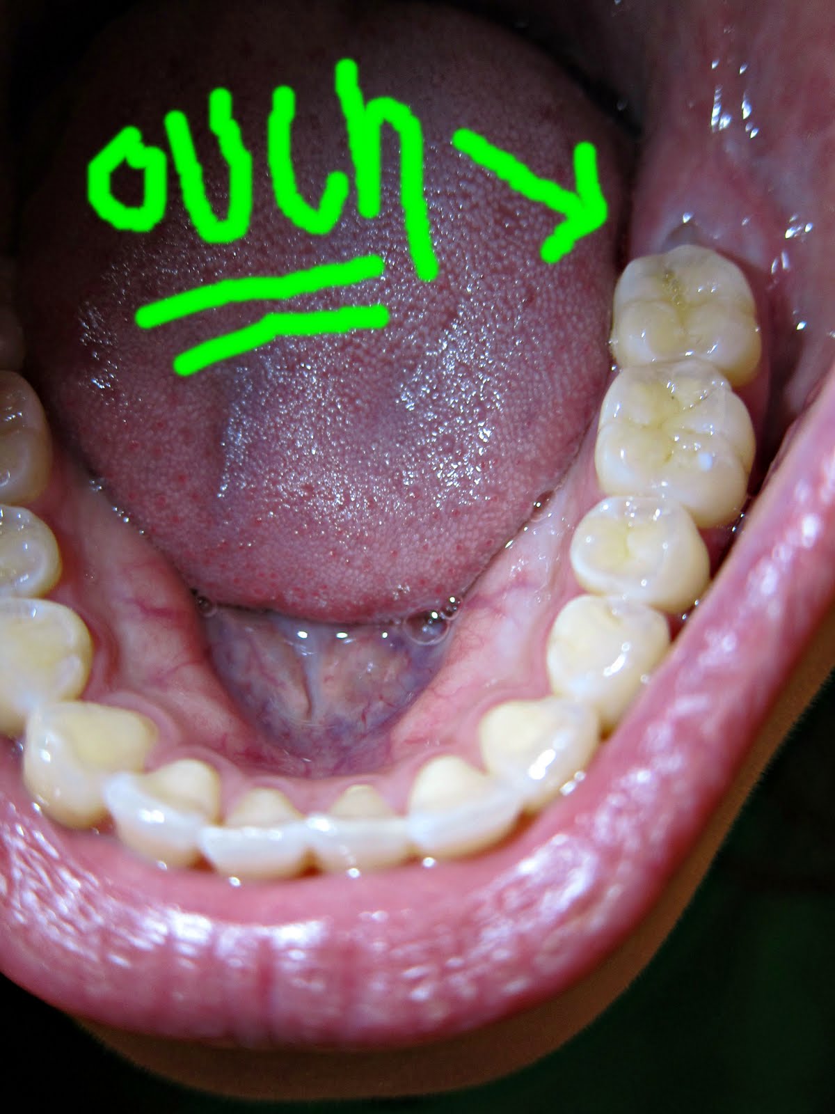 // margie says boo // OUCH OUCH OUCH