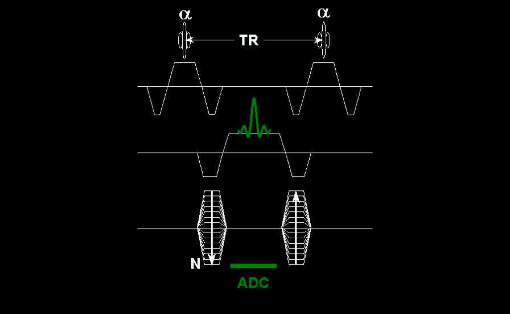 MRI BLOG: Pulse Sequences for Cardiac MRI