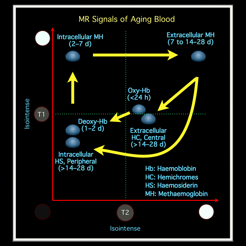 Mri Hemorrhage Timeline Chart | Magnetic Resonance Imaging in Acute ...