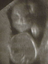 Chloe's Ultrasound Picture