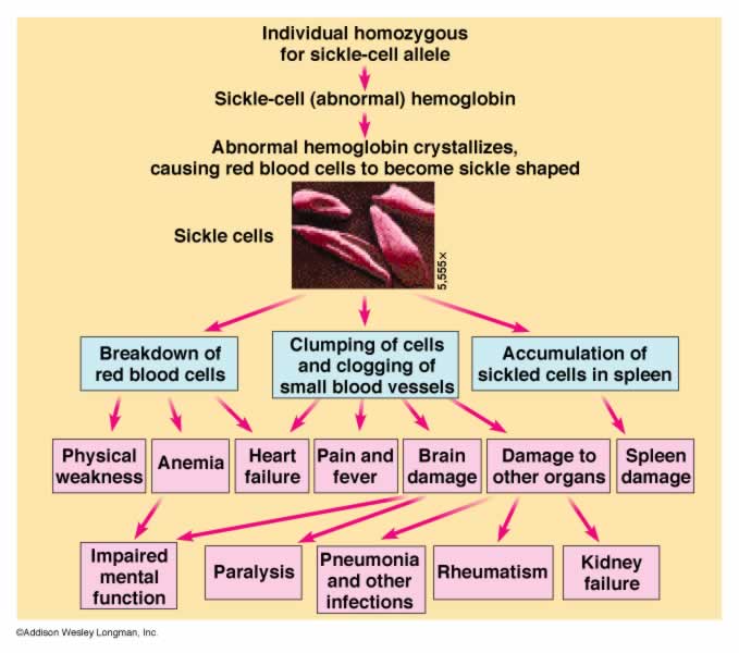doctors-gates-diagram-for-effects-of-sickle-cell-anemia