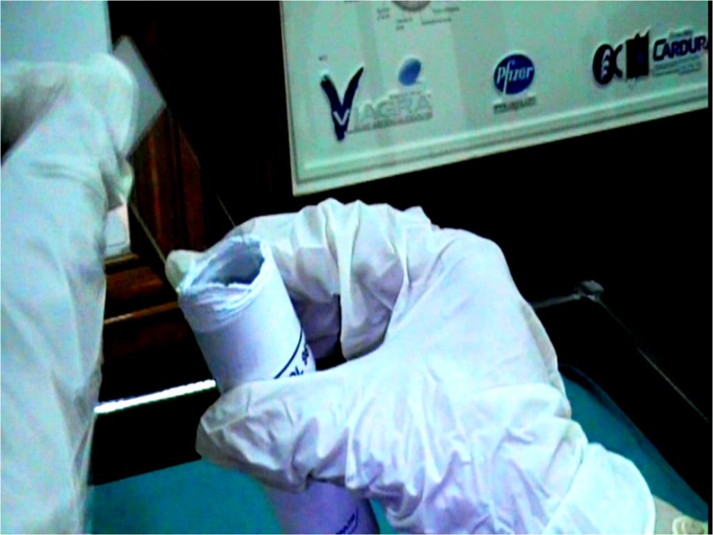 My Medical Notes Pap Smear Technique