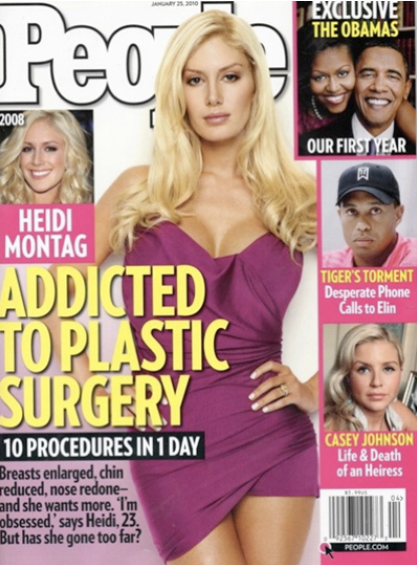 heidi montag surgery before after. heidi montag surgery before