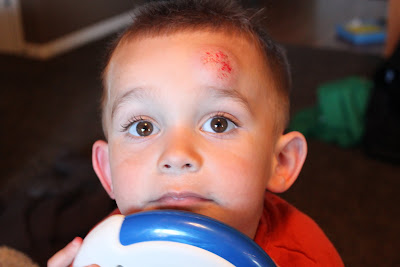 head bump forehead his mason small