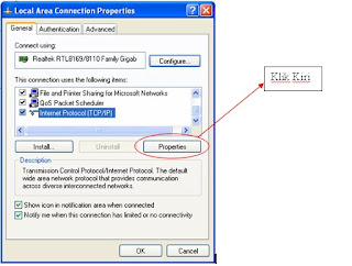 Setting LAN Setting Local Area Connection Properties