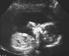 Baby Slate - 19 Weeks