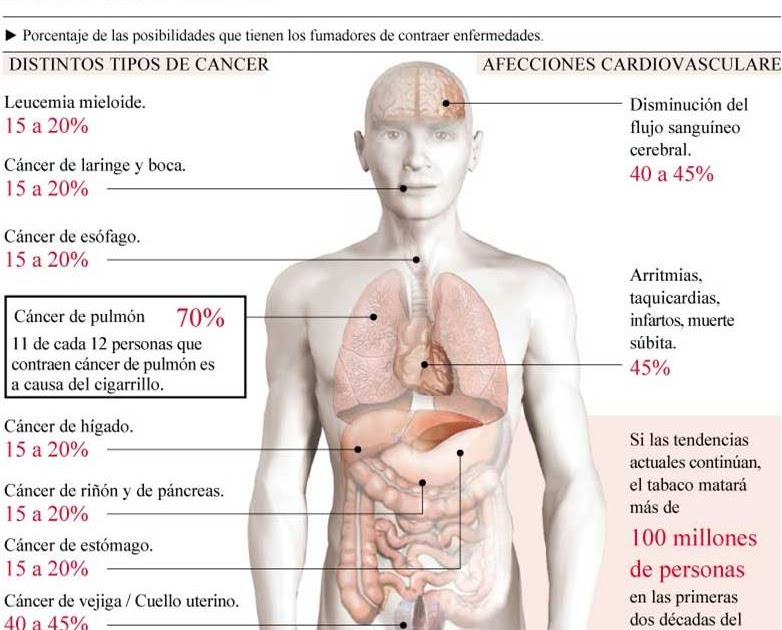 Mente sana en cuerpo sano Los Riesgos del Tabaco Mente sana en cuerpo sano Los Riesgos del Tabaco