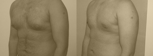 Before and After : See the Difference