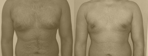 Before and After : See the Difference