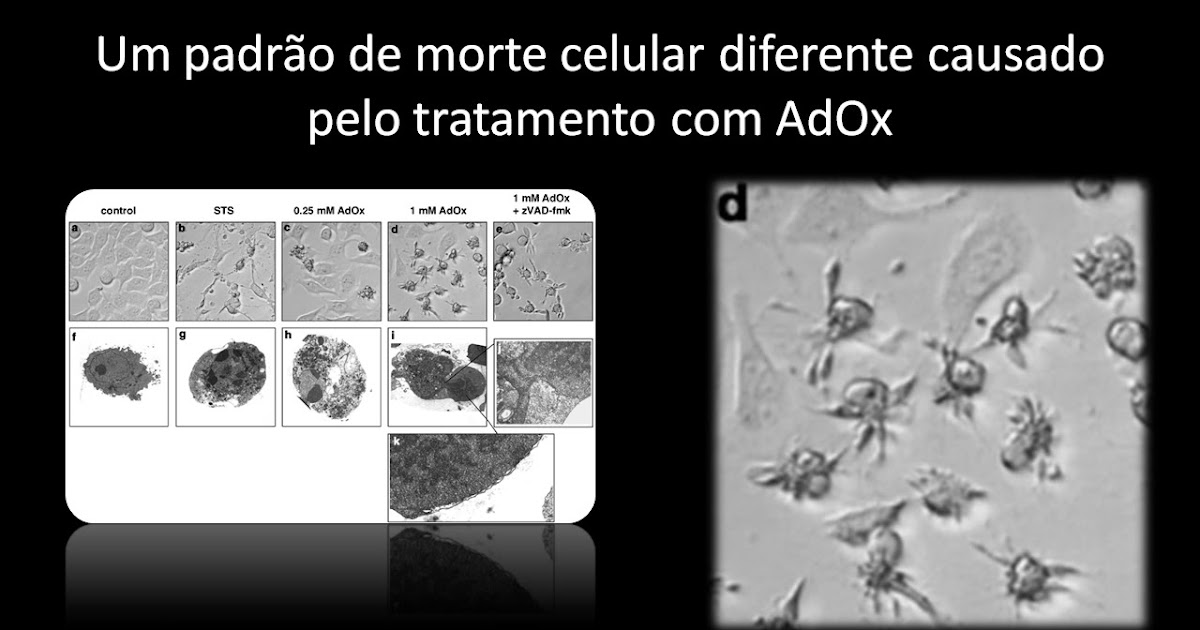 Patologia Básica Outra forma de morte celular