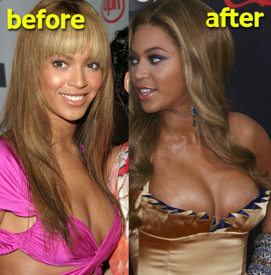 http://4.bp.blogspot.com/_bQ0SqifjNcg/S2u5HxP_VaI/AAAAAAAAPbA/l5lsJntn73Y/s1600/beyonce-breast-implants.jpg