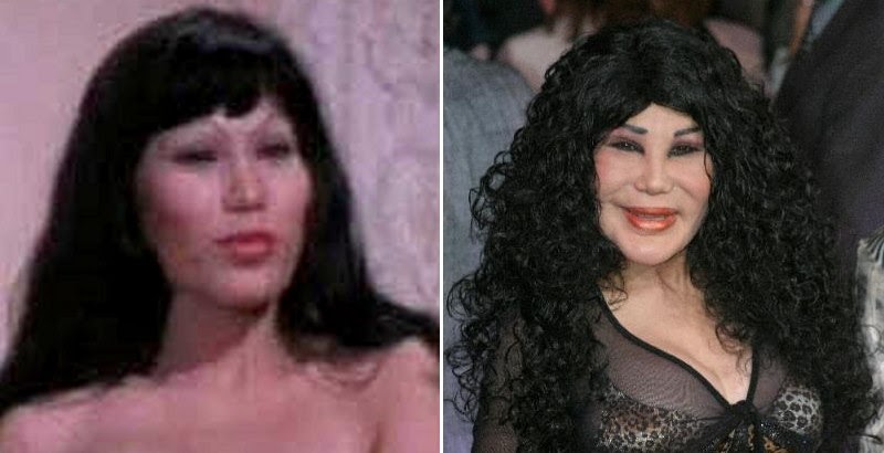 Lyn May Plastic Surgery Before After.